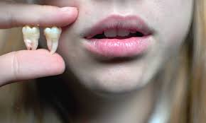 Mitos e Verdades sobre os Dentes e o Corpo